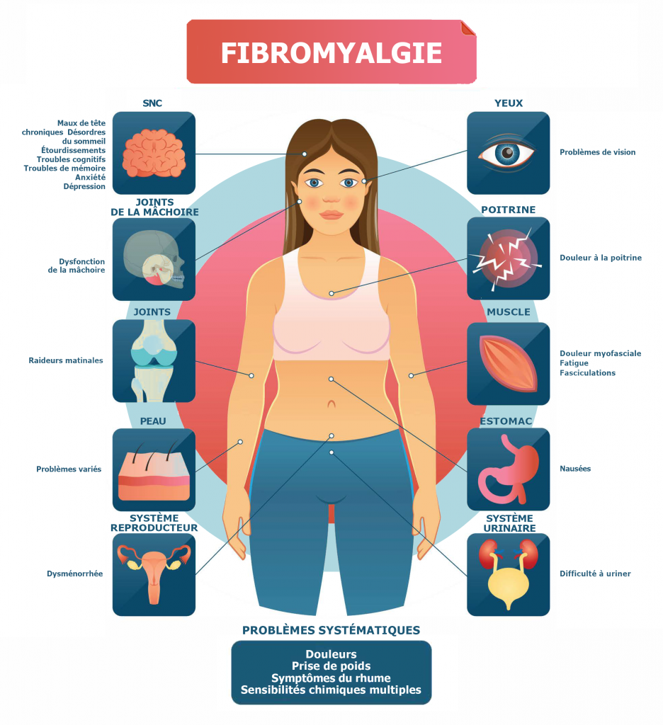 Fibromyalgie : Les Meilleures Solutions Naturelles pour Soulager les Douleurs